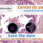 Cancer du Pancréas