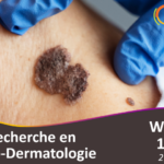 Webinaire "Recherche en Onco-Dermatologie"